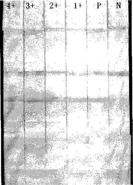 Method for quickly processing filter-type micro nucleic acid clinical samples