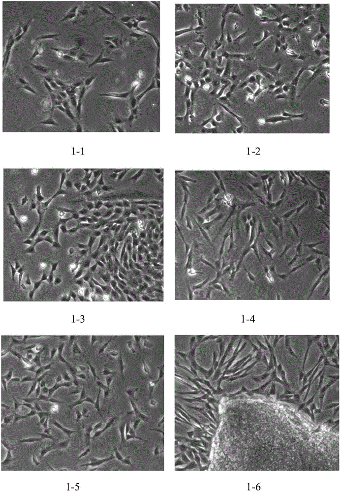 Placental villus plate mesenchymal stem cells and extraction method thereof