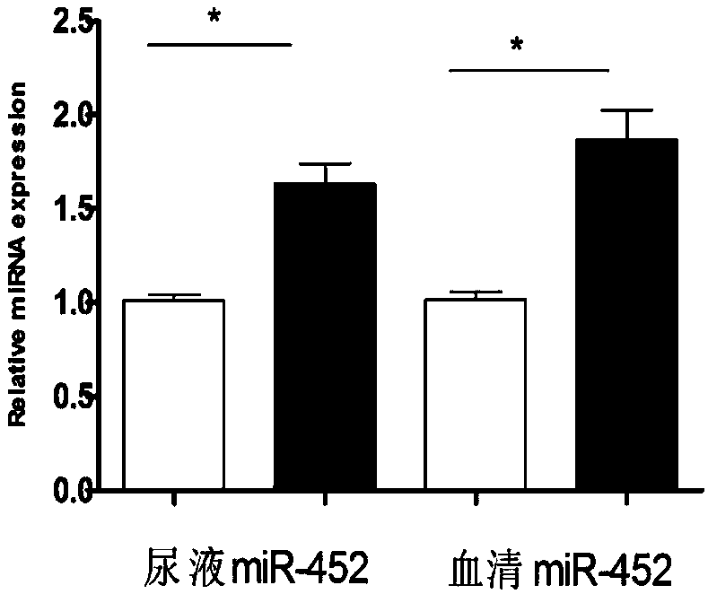 Molecular marker miR-452 for early diagnosing acute kidney injury caused by septicopyemia, kit and application thereof