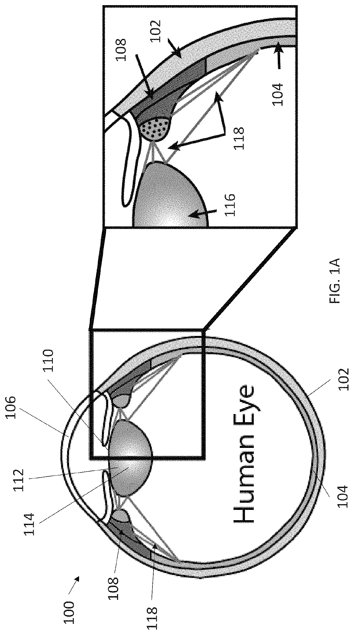 System and methods using real-time predictive virtual 3D eye finite element modeling for simulation of ocular structure biomechanics