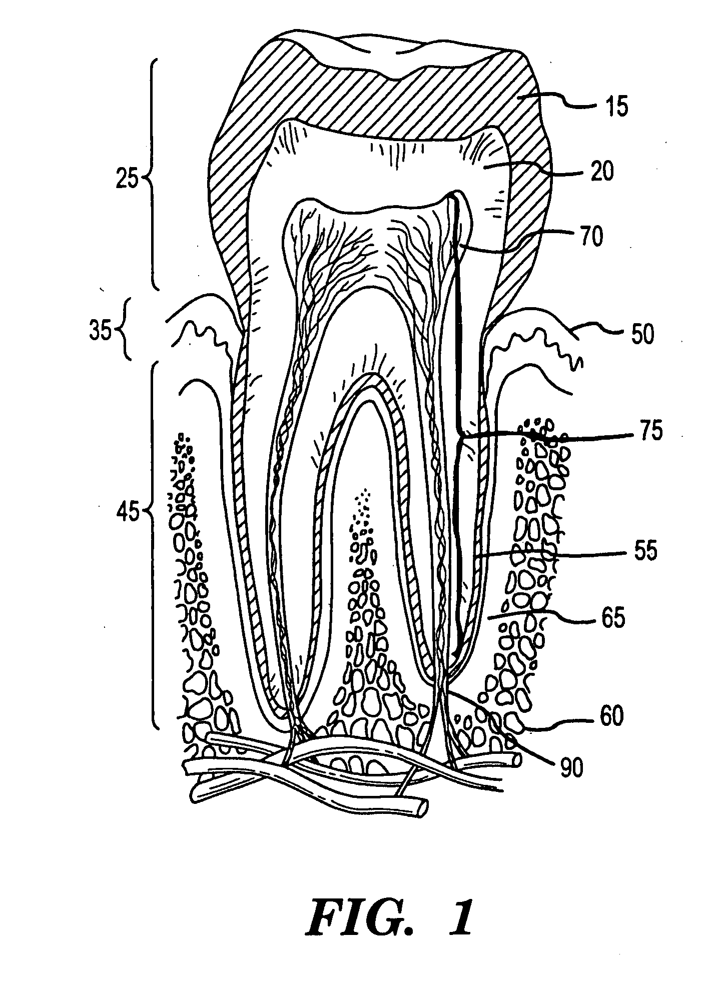 Methods for treating dental conditions using tissue scaffolds