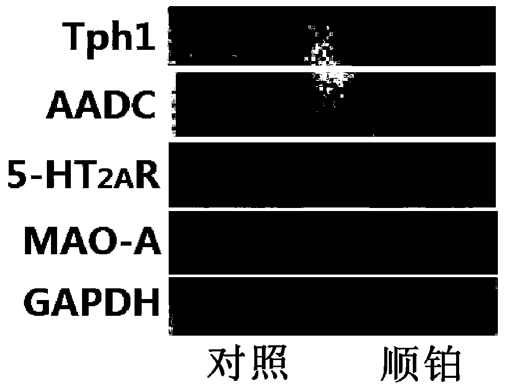 Application of compound drug composition in preparing drug for treating acute kidney injury