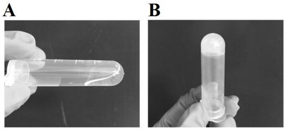 Preparation method and application of magnetic exosome-entrapped refractory wound dressing