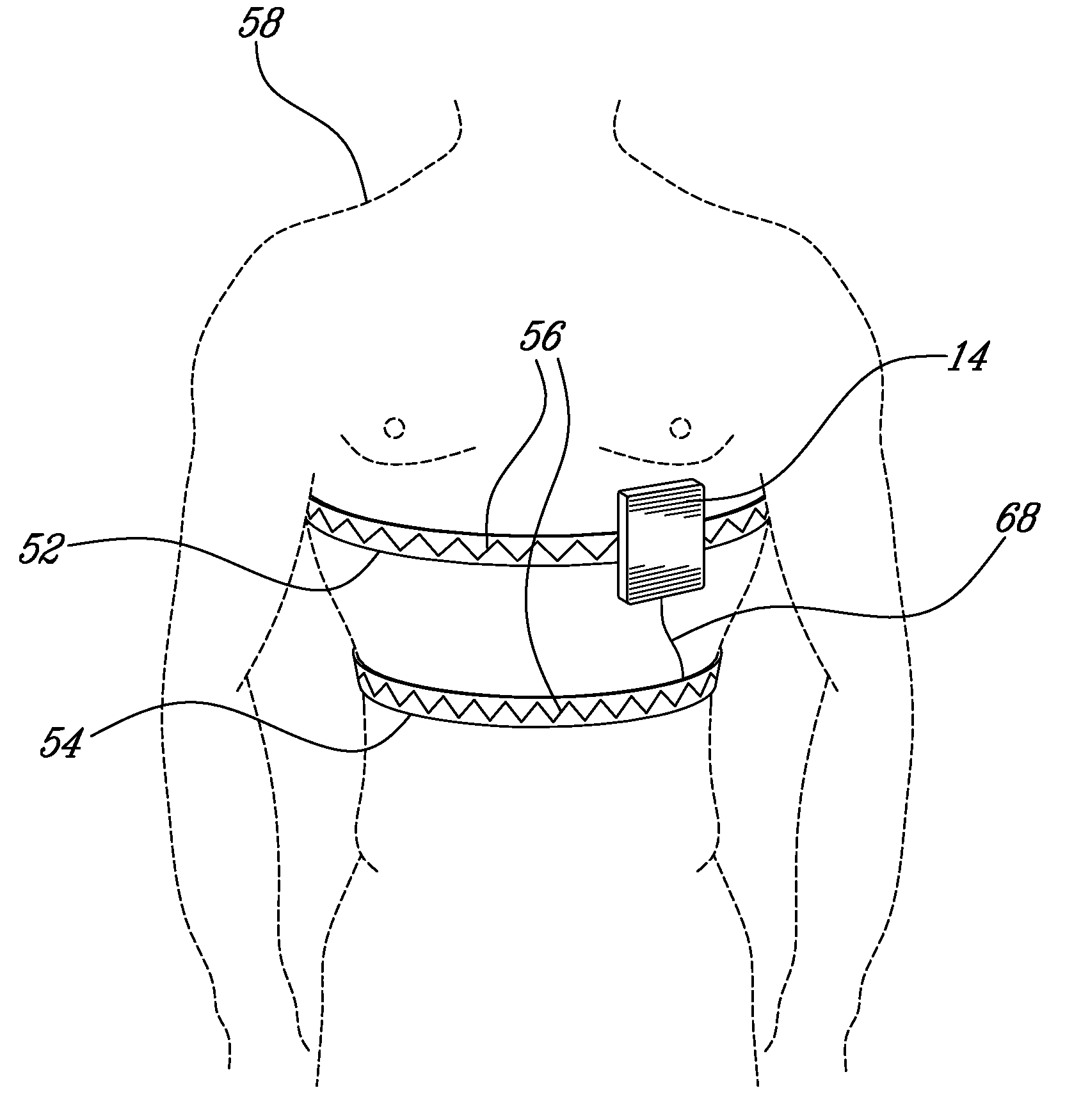 Physiologic sensor apparatus