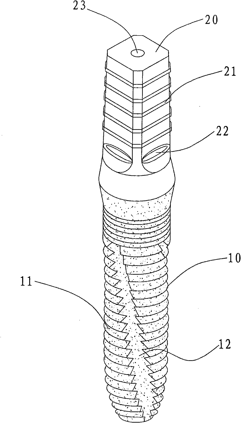 Dental artificial implant and production method thereof