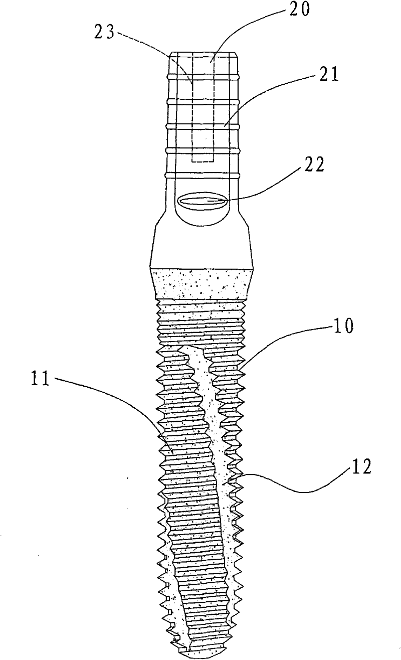 Dental artificial implant and production method thereof