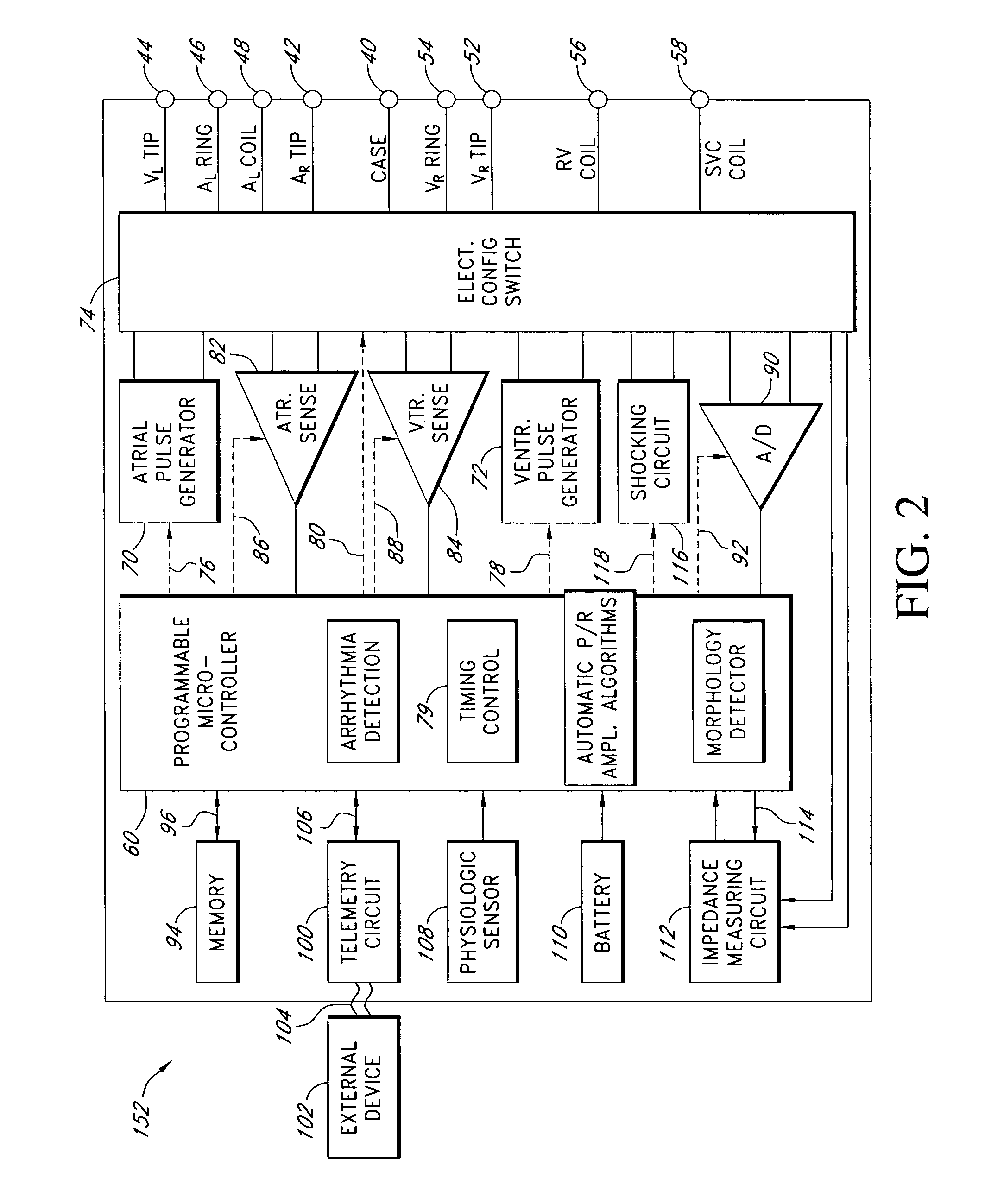 Automatic signal amplitude measurement system in the setting of abnormal rhythms