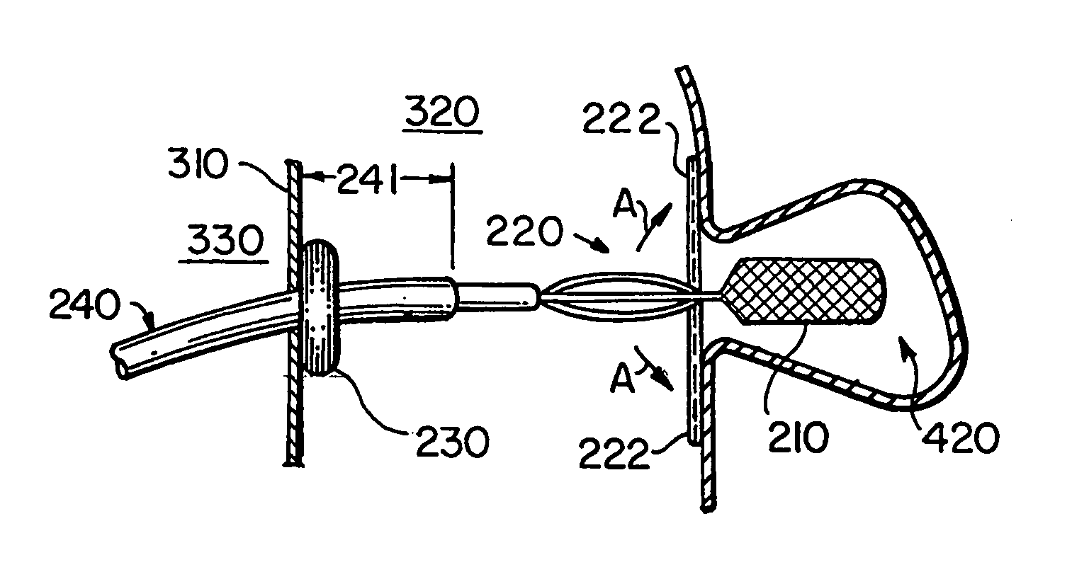 Apparatus for implanting devices in atrial appendages