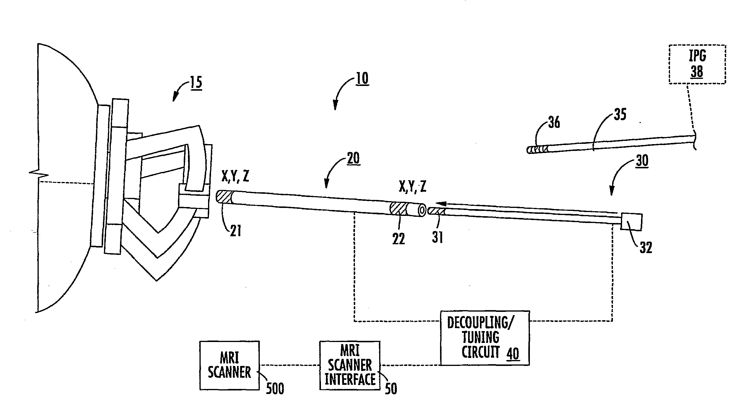 Mri-guided localization and/or lead placement systems, related methods, devices and computer program products