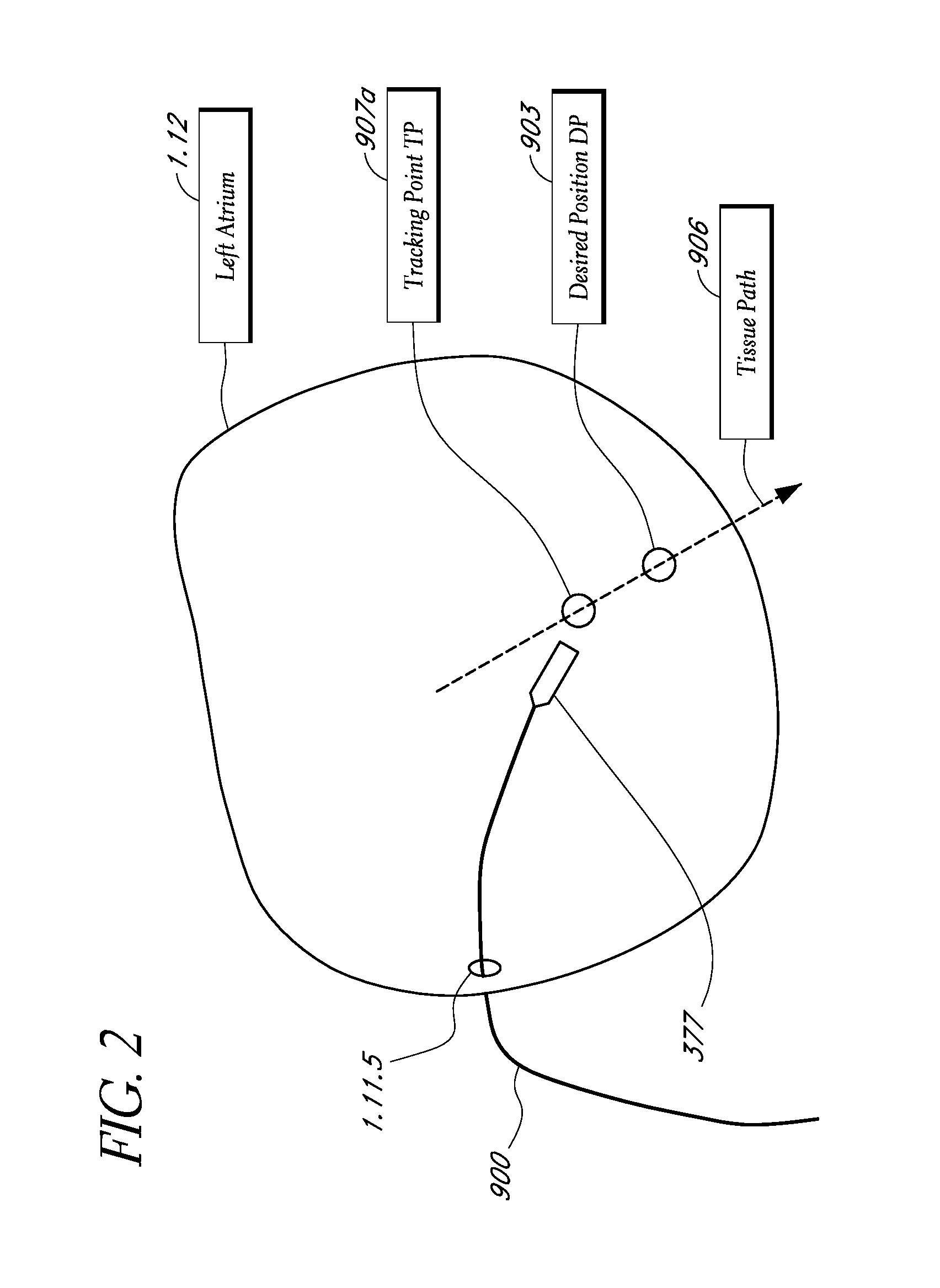 Method and apparatus for creating a high resolution map of the electrical and mechanical properties of the heart