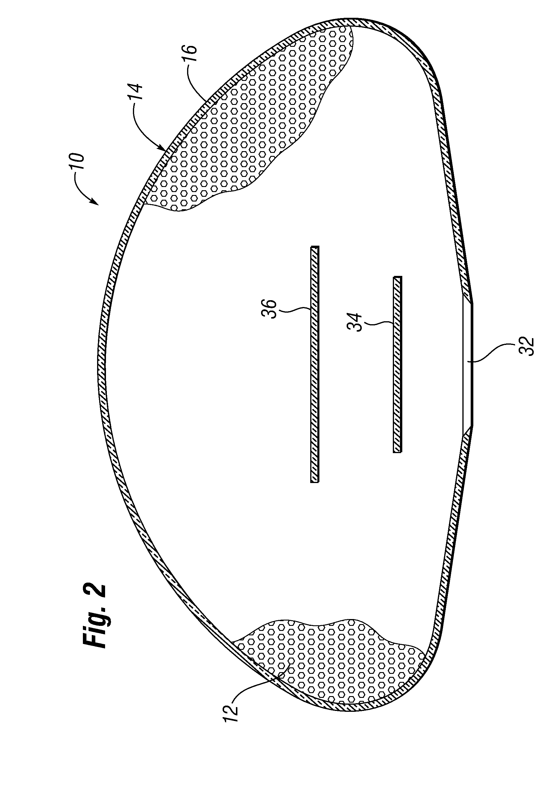 All-barrier elastomeric gel-filled breast prosthesis