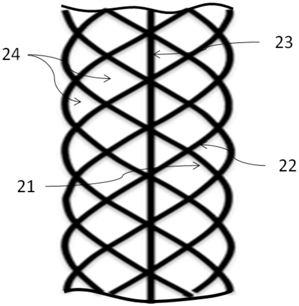 Ureteral stent and use method thereof