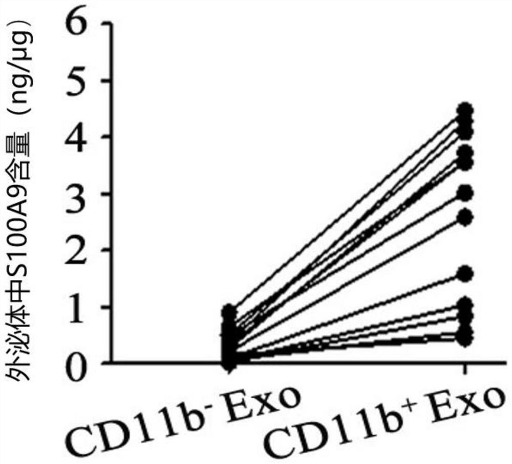 Application of CD11b positive exosome in tumor prognosis evaluation