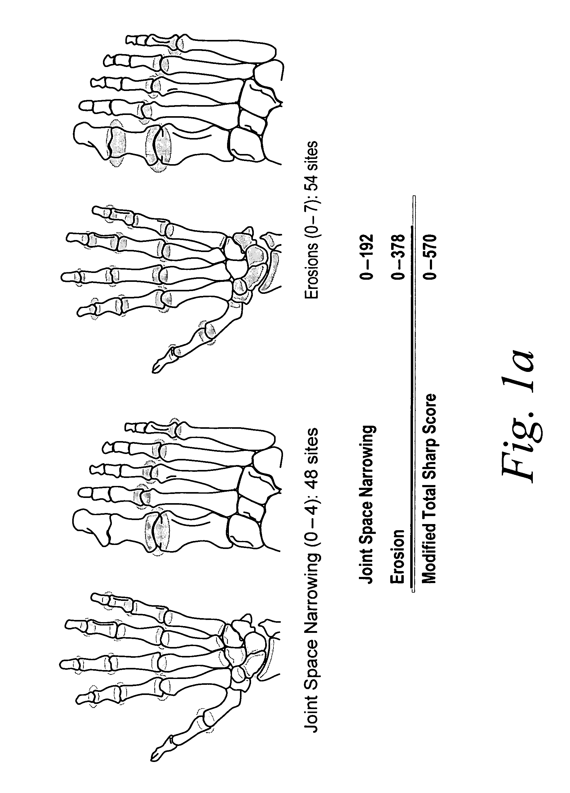 Use of human TNFα antibodies for treatment of erosive polyarthritis