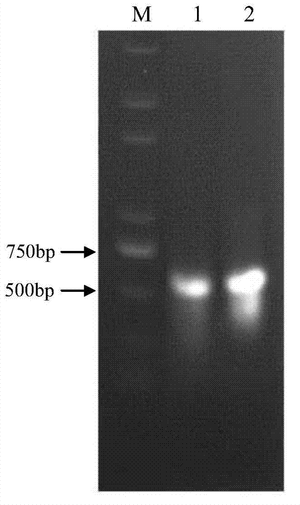 Carboxylesterase gene dsRNA and applications thereof in prevention and treatment of sitobion avenae