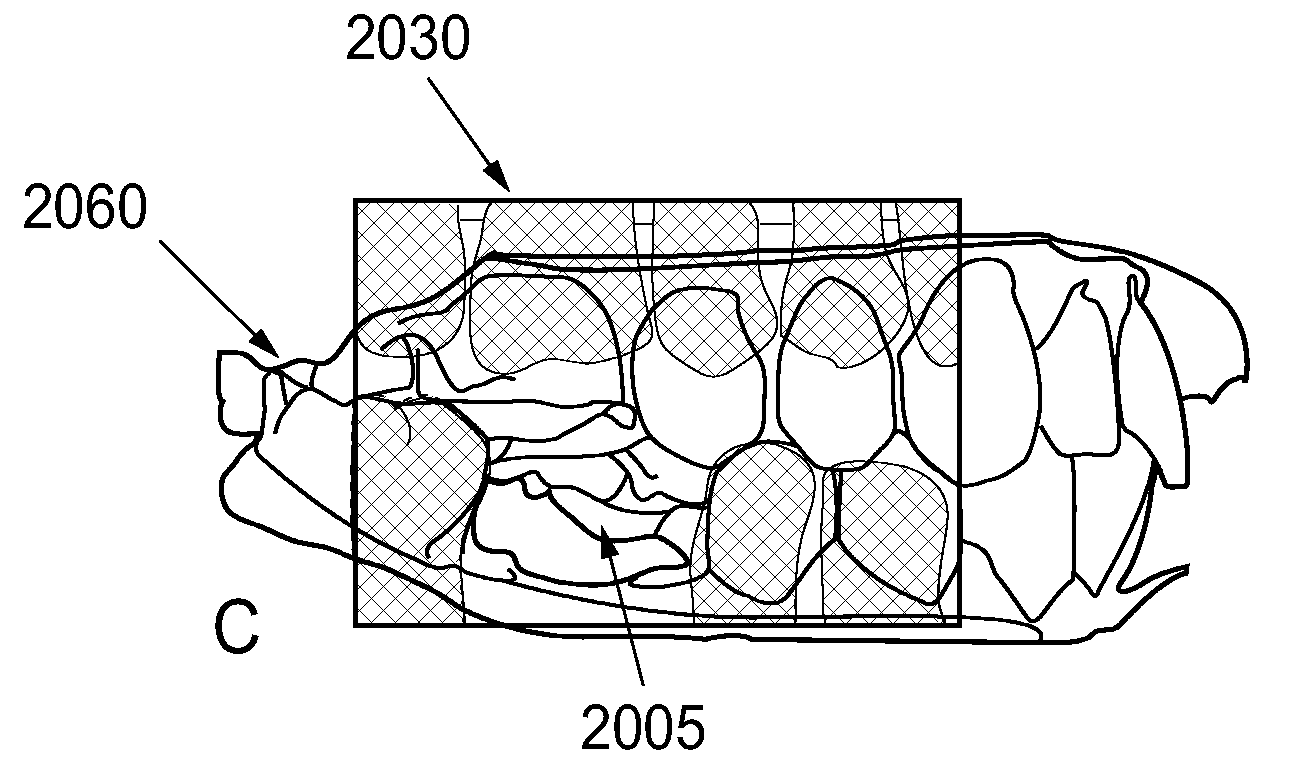 Method and system for dental planning and production
