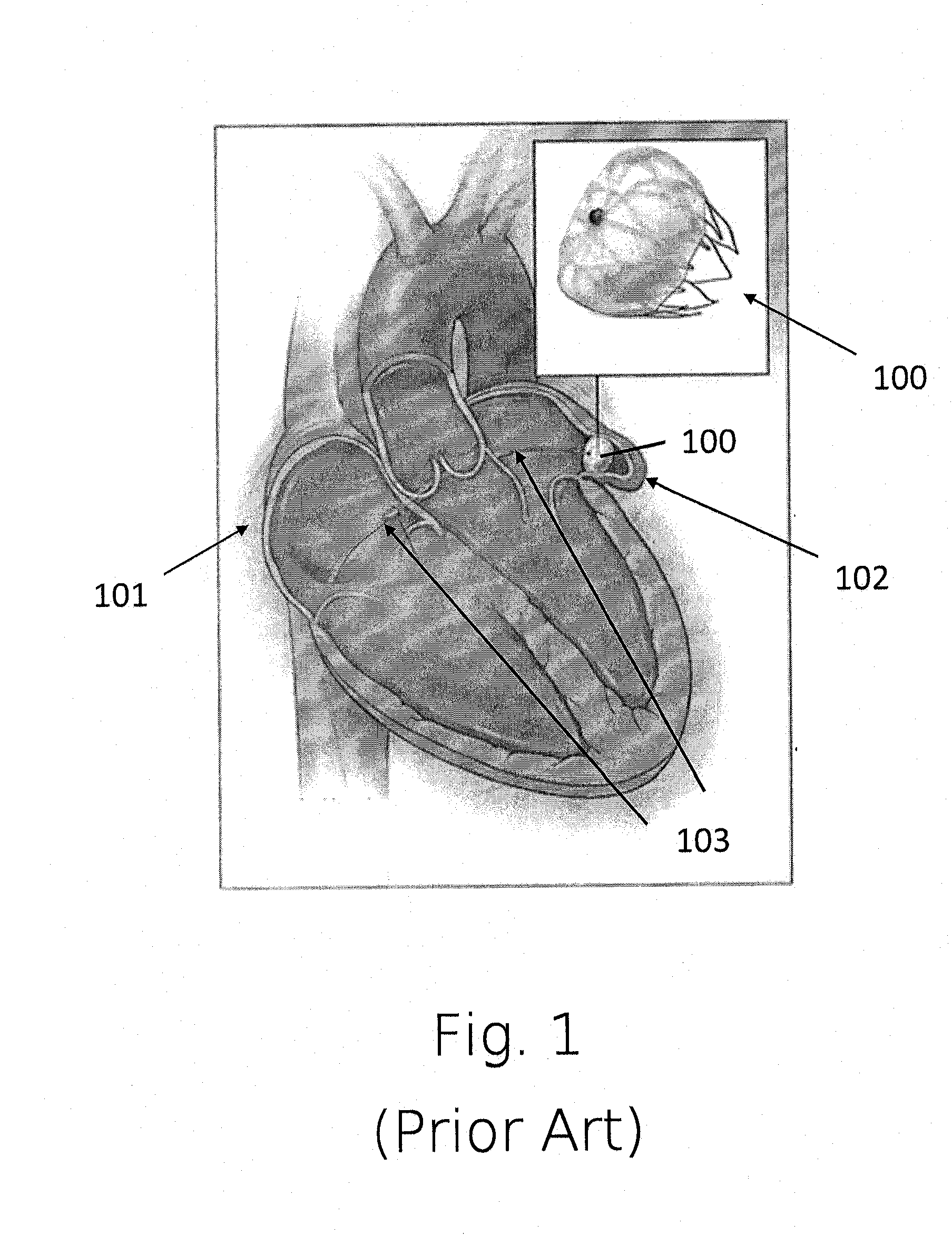 Body part repositioning apparatus and method