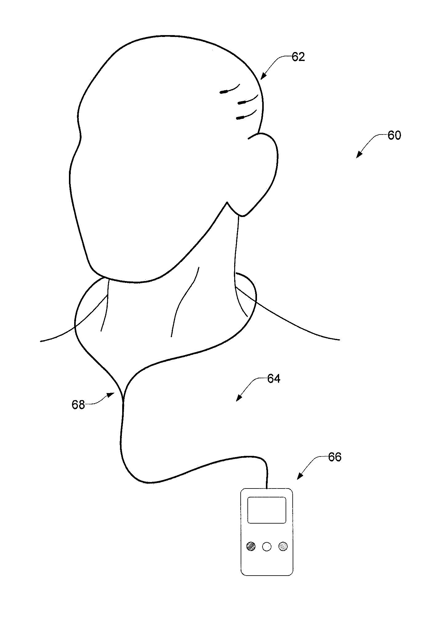 Implantable systems and methods for identifying a contra-ictal condition in a subject