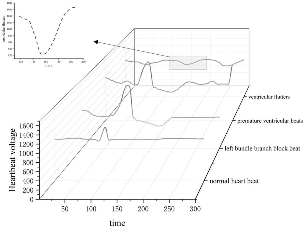 Heart disease computer-aided classification method based on continuous coherence and Fourier transform