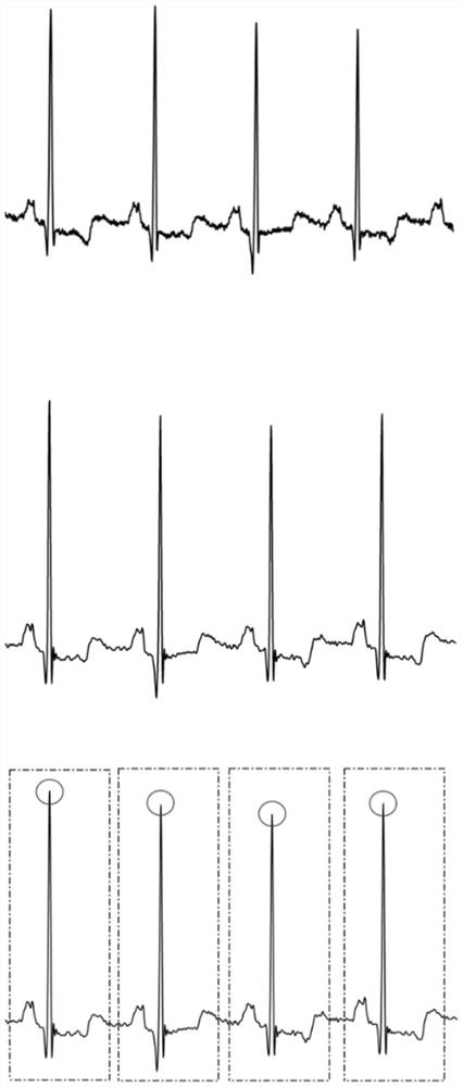 Heart disease computer-aided classification method based on continuous coherence and Fourier transform