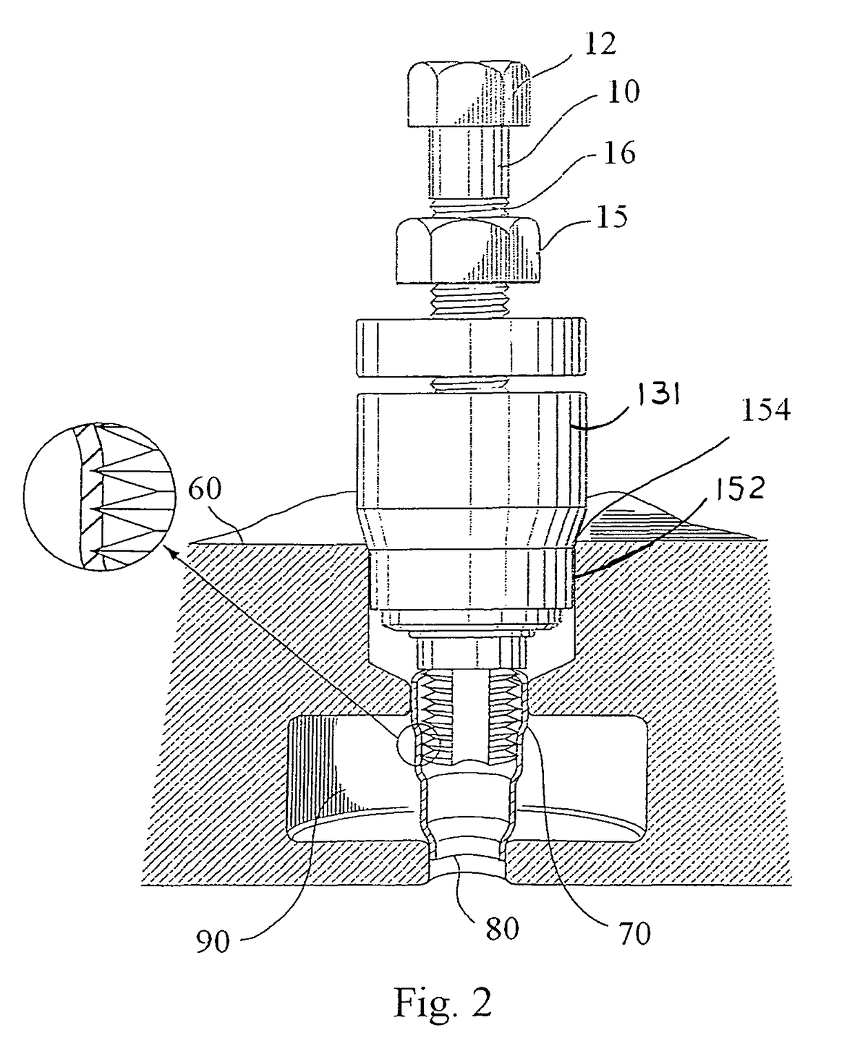 Injector sleeve removal tool