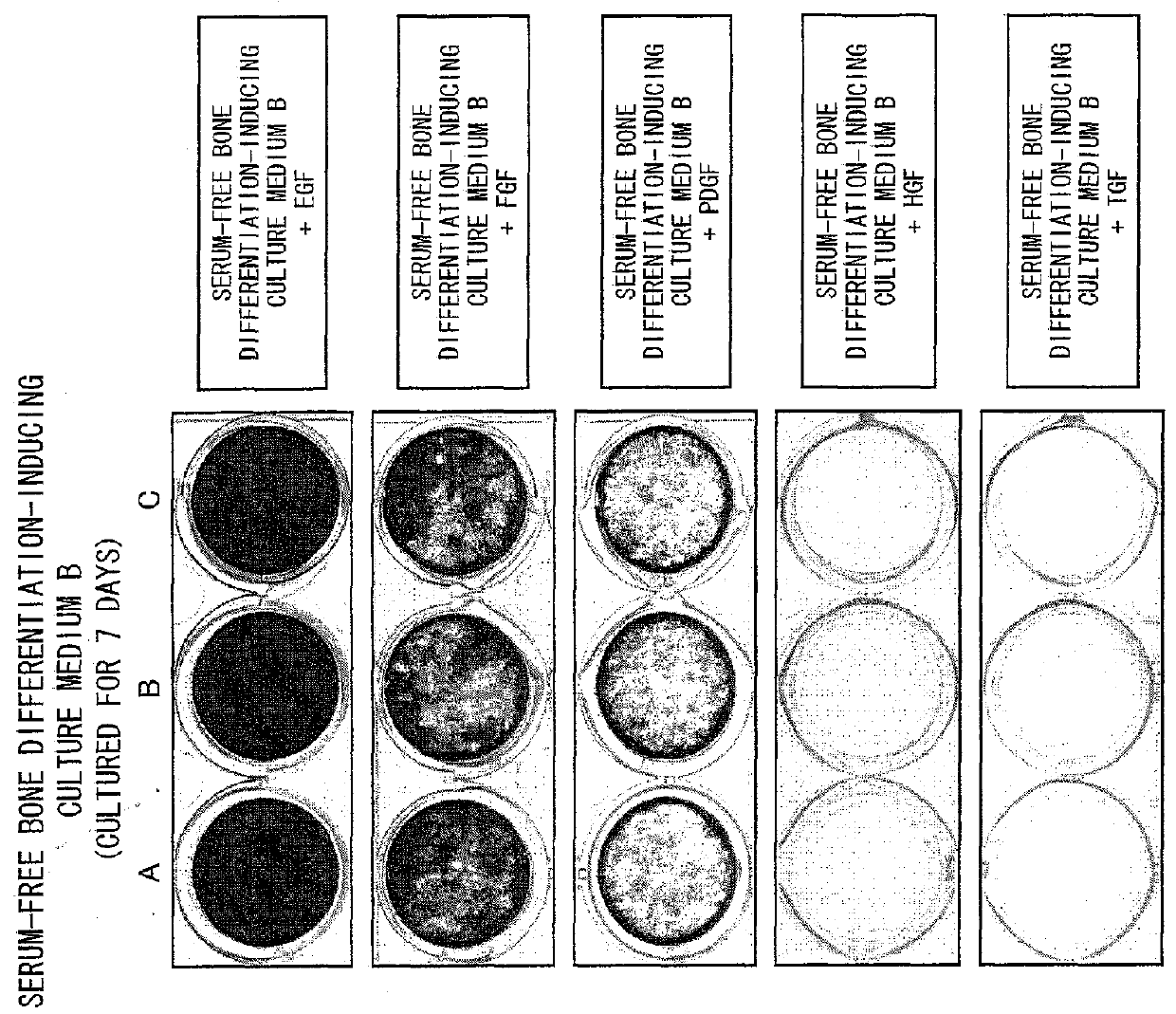 Differentiation-inducing culture medium additive and use thereof