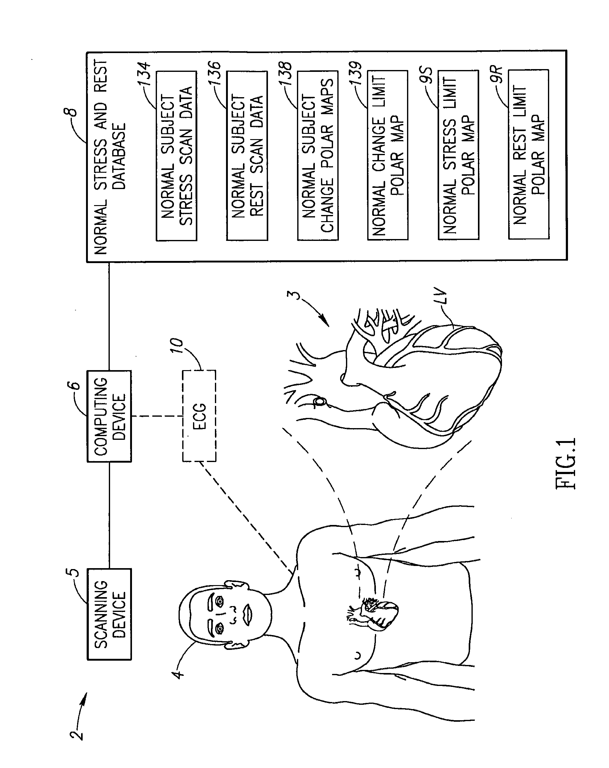 Method of determining ischemia using paired stress and rest scans