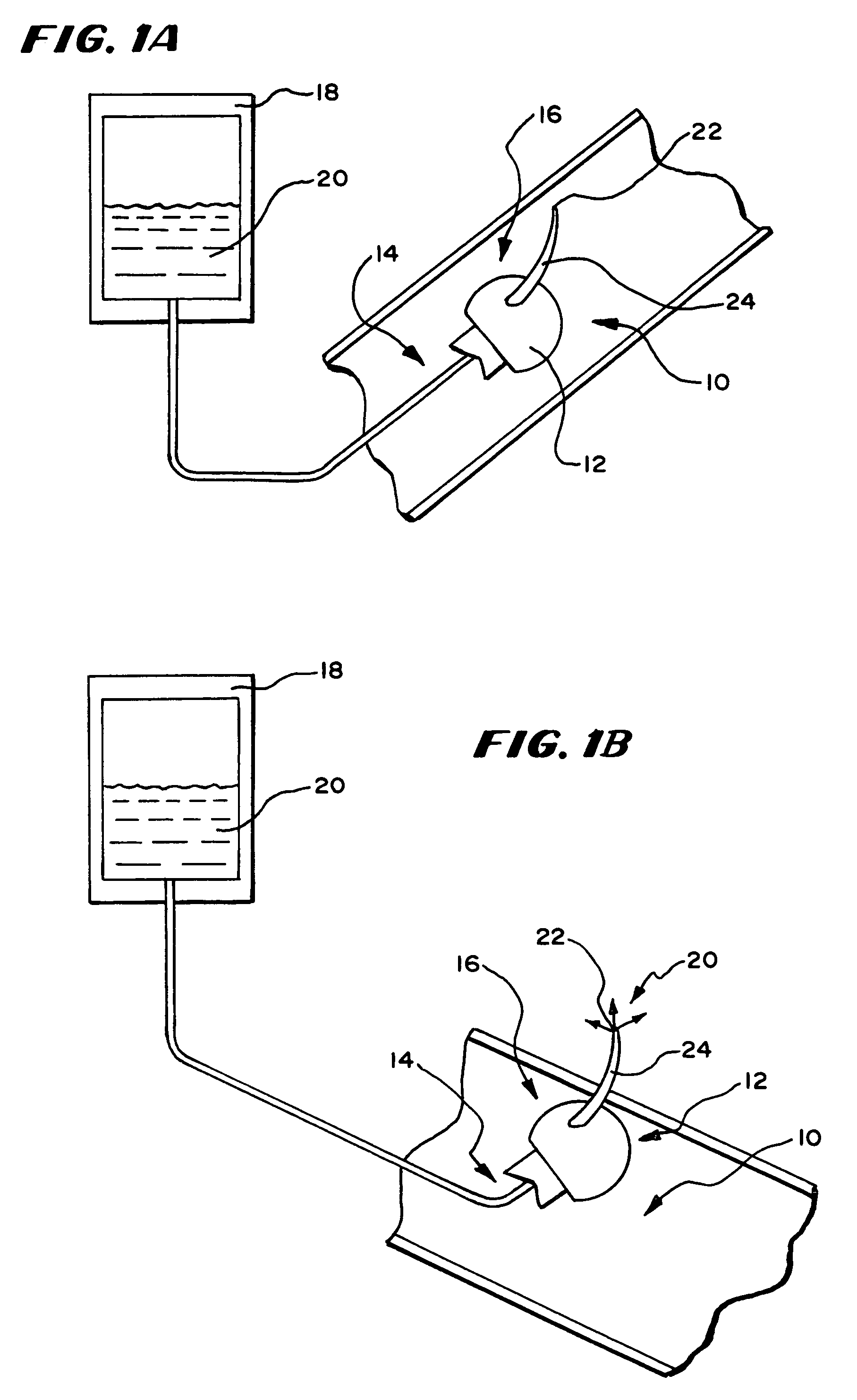 Systems and methods for applying a selected treatment agent into contact with tissue to treat disorders of the gastrointestinal tract