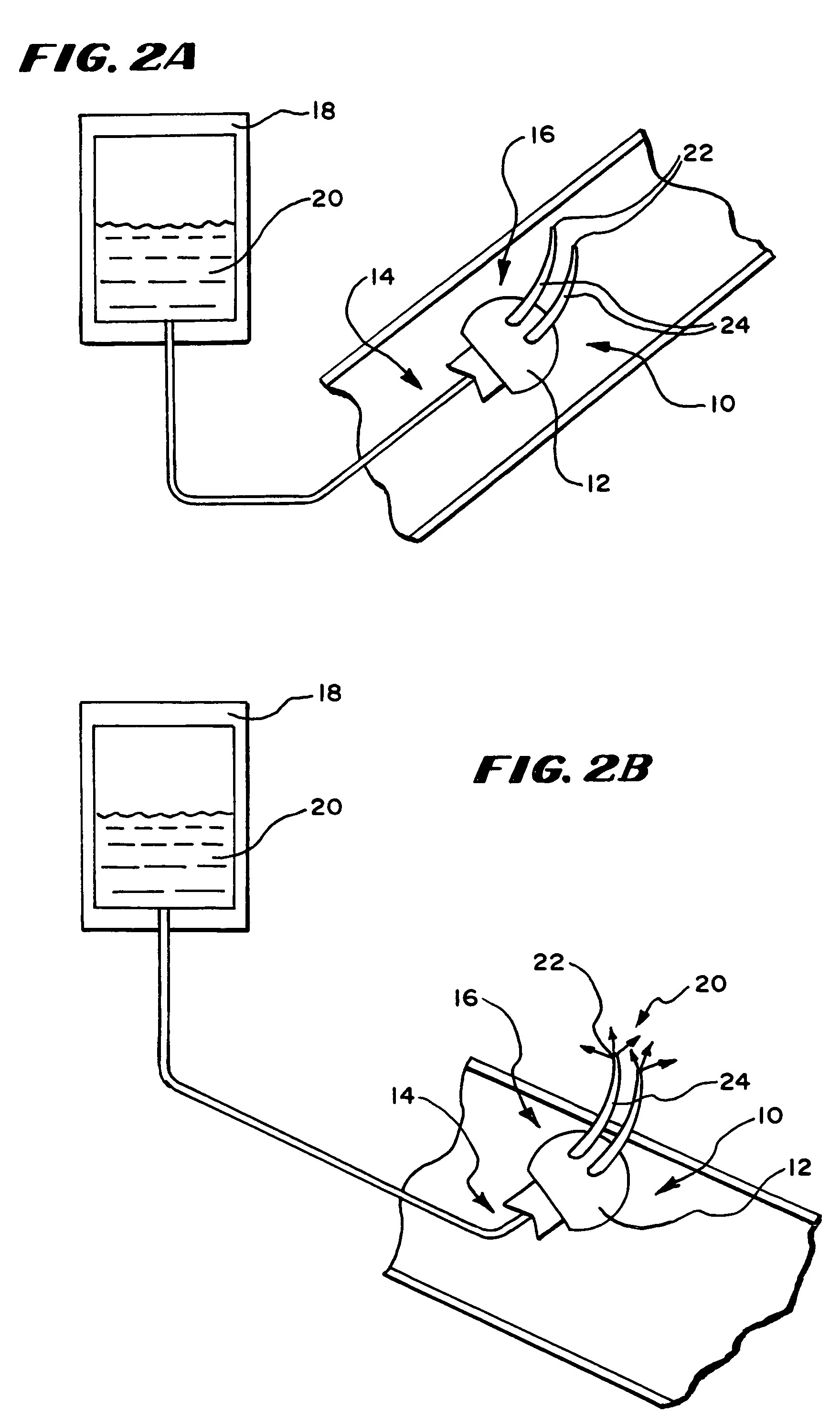 Systems and methods for applying a selected treatment agent into contact with tissue to treat disorders of the gastrointestinal tract