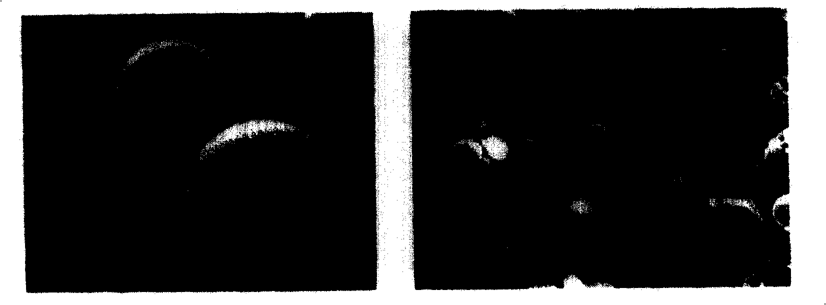 Cyclosporine microball preparation for treating endophthalmitis