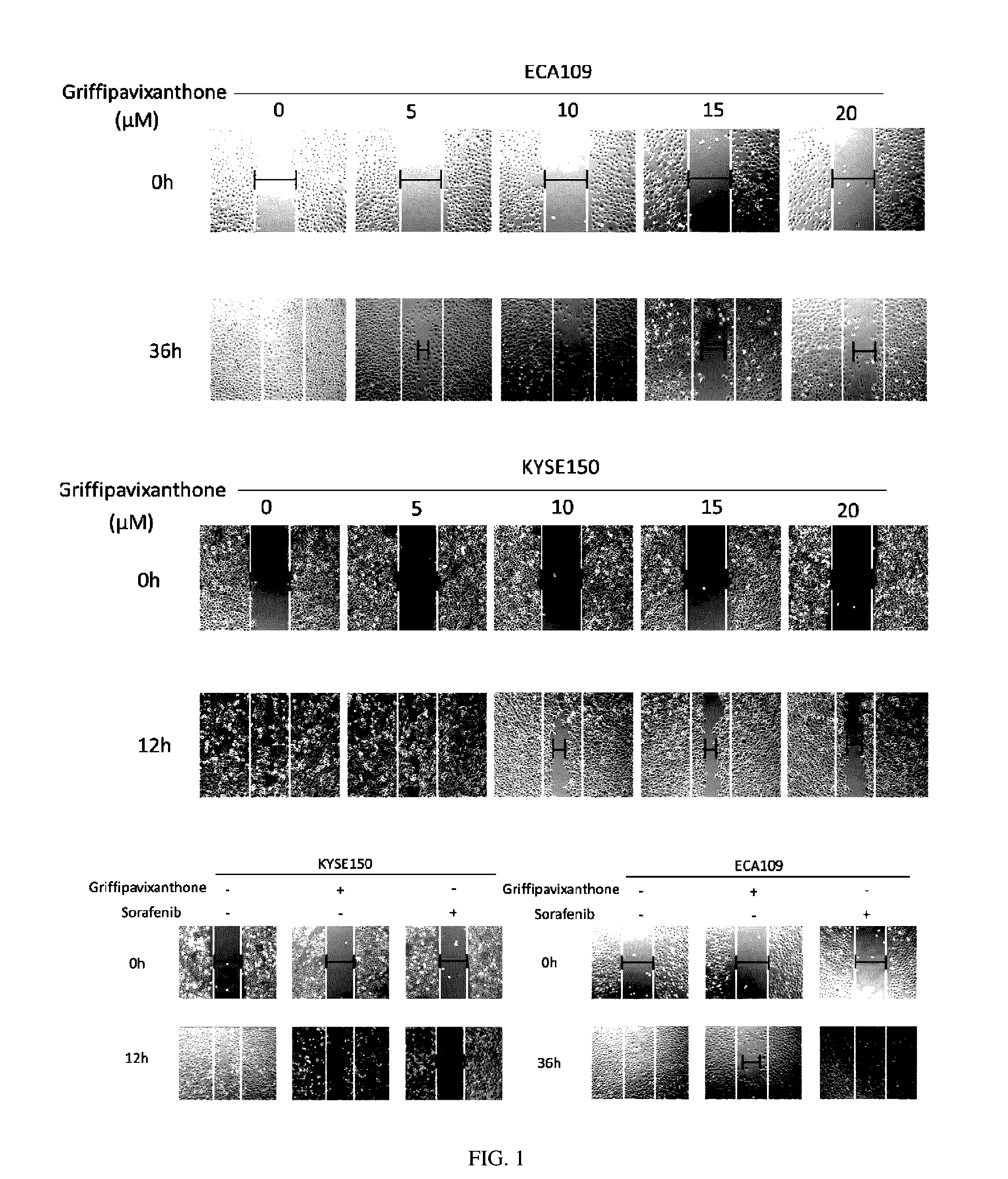 Medical use of compound from <i>Garcinia esculenta</i>