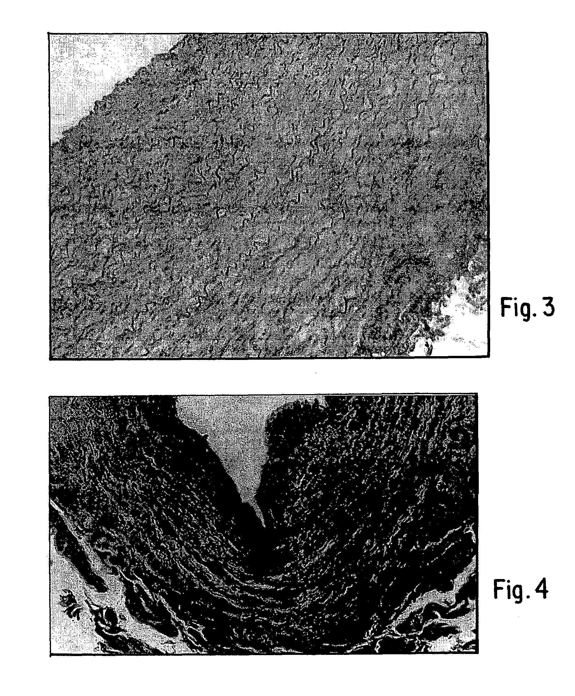 Process for decellularizing soft-tissue engineered medical implants, and decellularized soft-tissue medical implants produced