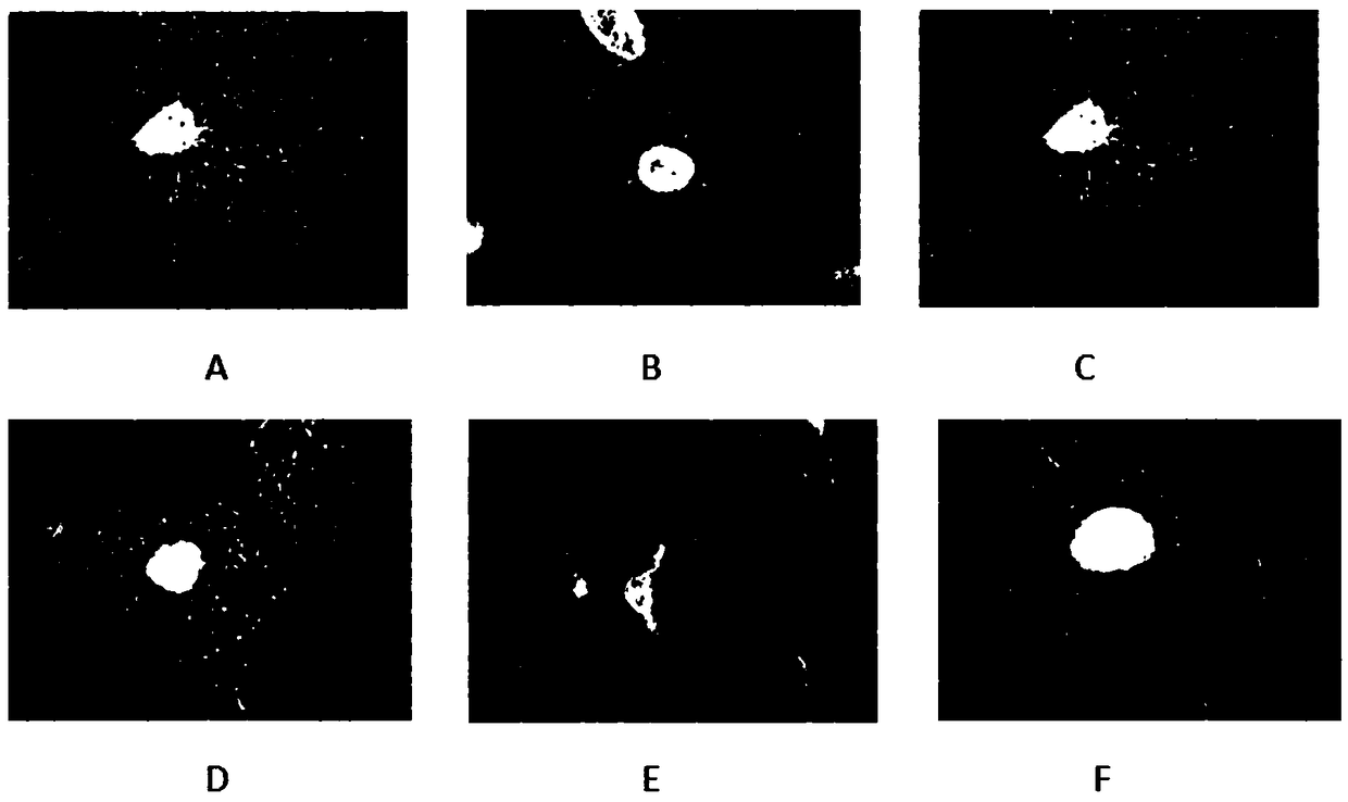 Novel application of blueberry general flavone