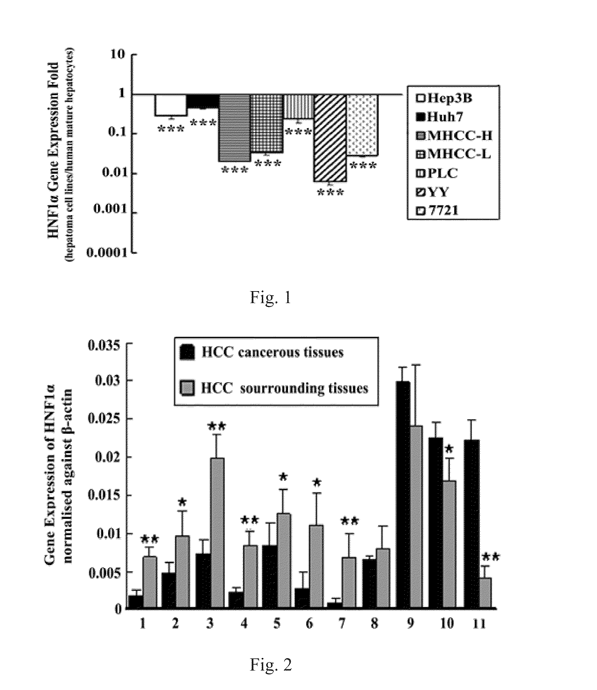 Use of hepatocyte nuclear factor 1a in preparation of drug for treating malignant solid tumor disease