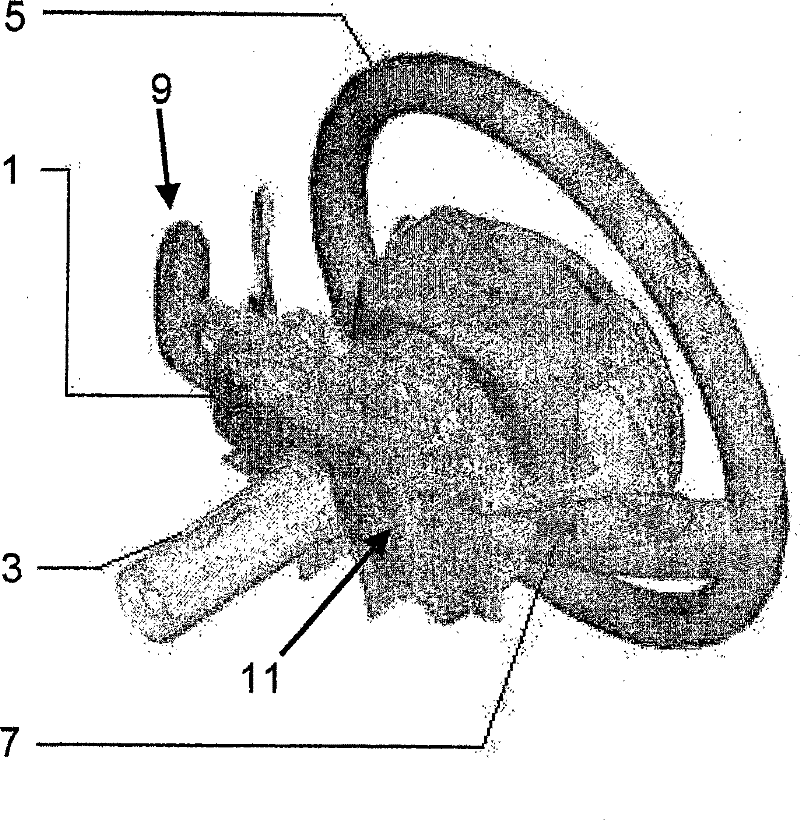 Control assembly, in particular for motor vehicle steering column top portion