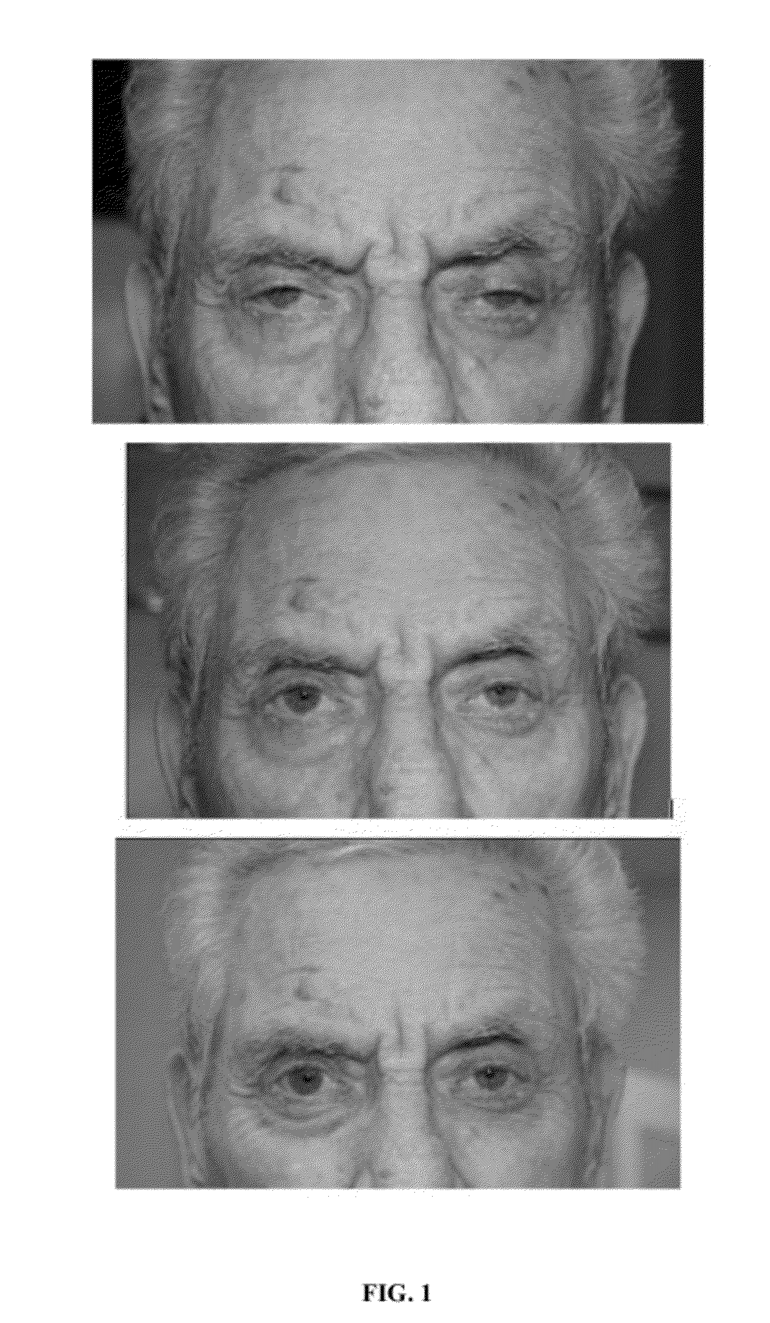 Compositions and methods for non-surgical treatment of ptosis
