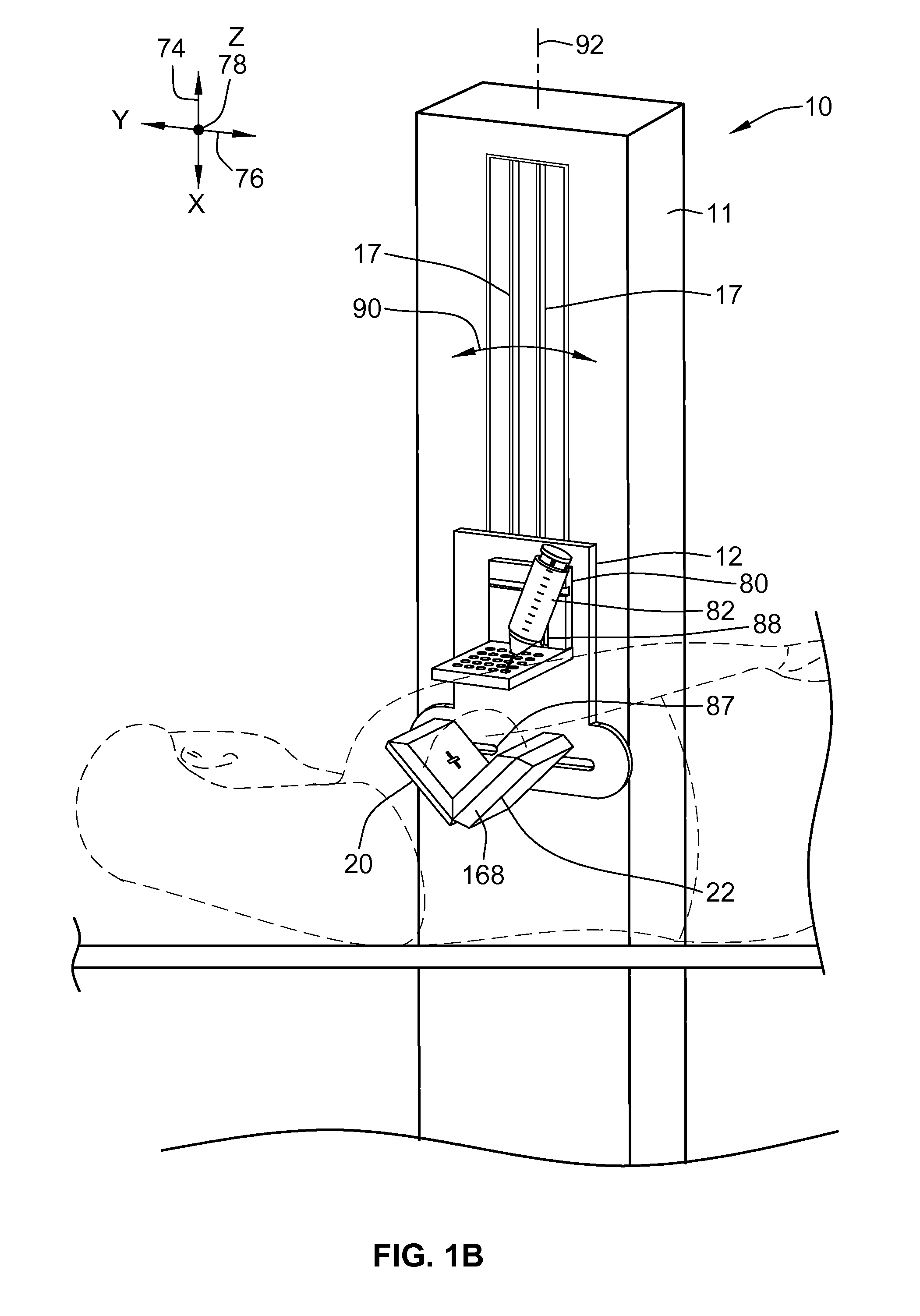 Gamma camera for performing nuclear mammography imaging