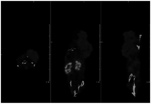 A radiolabeled tumor imaging agent, its preparation method and application