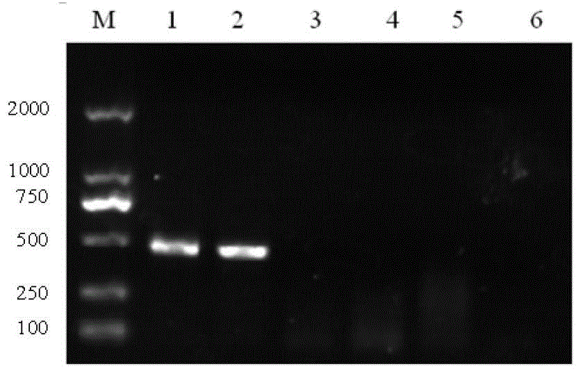 RT-PCR (reverse transcription-polymerase chain reaction) detection kit for viral haemorrhagic septicaemia virus and preparation method thereof