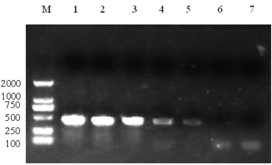 RT-PCR (reverse transcription-polymerase chain reaction) detection kit for viral haemorrhagic septicaemia virus and preparation method thereof