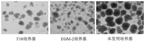 Young pig islet cell culture medium and application method thereof