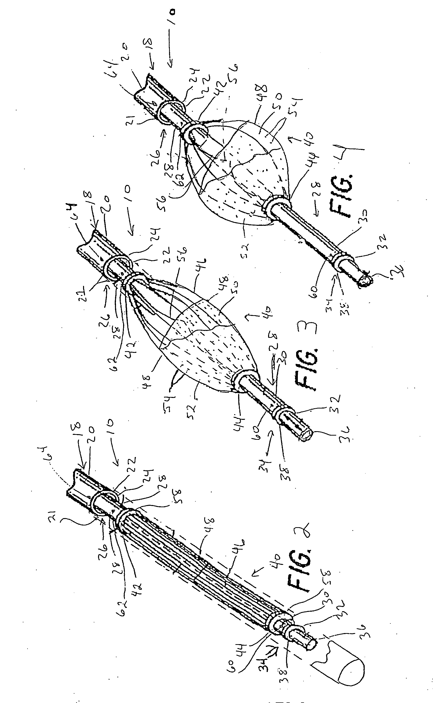 Apparatus for trapping emboli