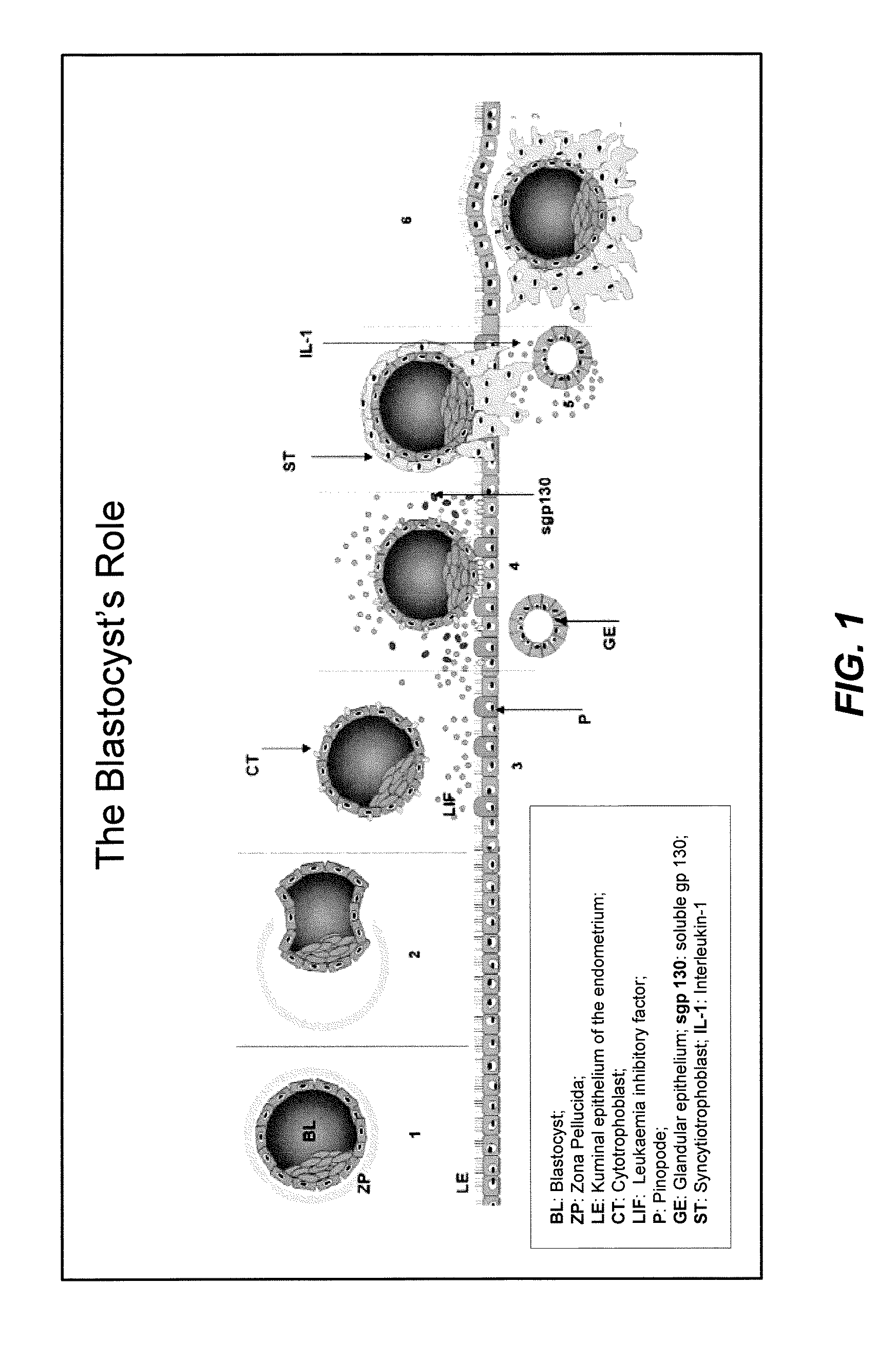 Secretome Profile-Facilitated In Vitro Fertilization