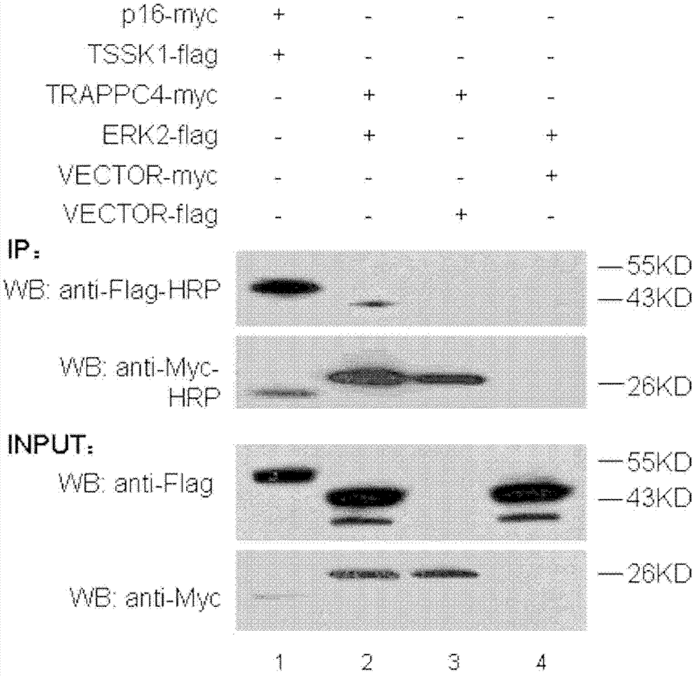 Small interfering RNA for TRAPPC4 gene target point, and uses thereof