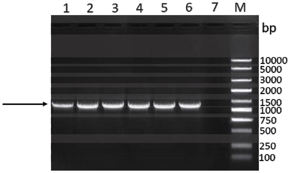 Genetic engineering subunit vaccine capable of resisting goat hydatidosis infection