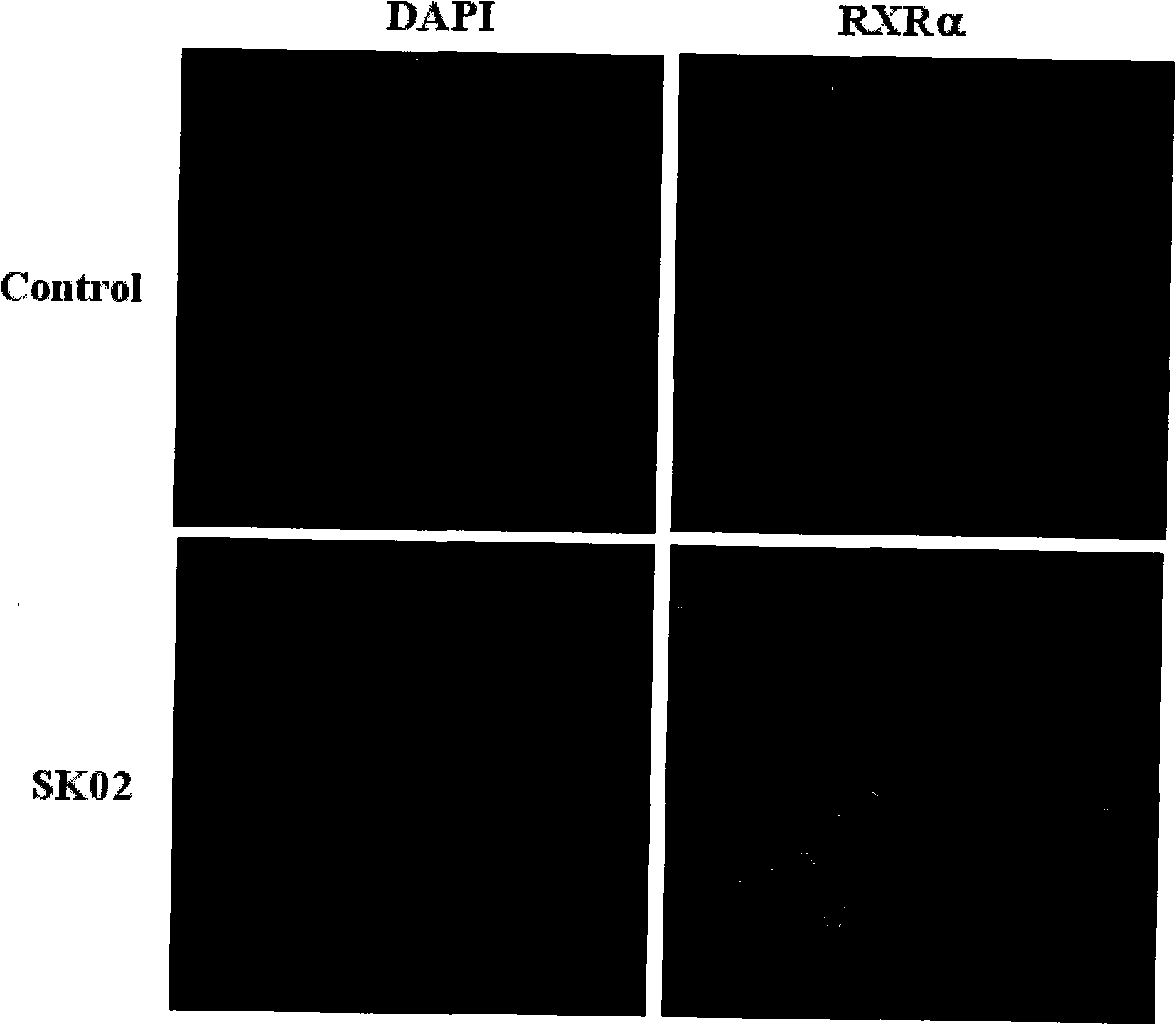 Use of retinol X receptor used for screening alkannin and derivates thereof