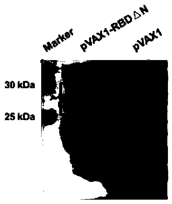 Corona Virus Disease 2019 (COVID-19) DNA vaccine and preparation method and application thereof