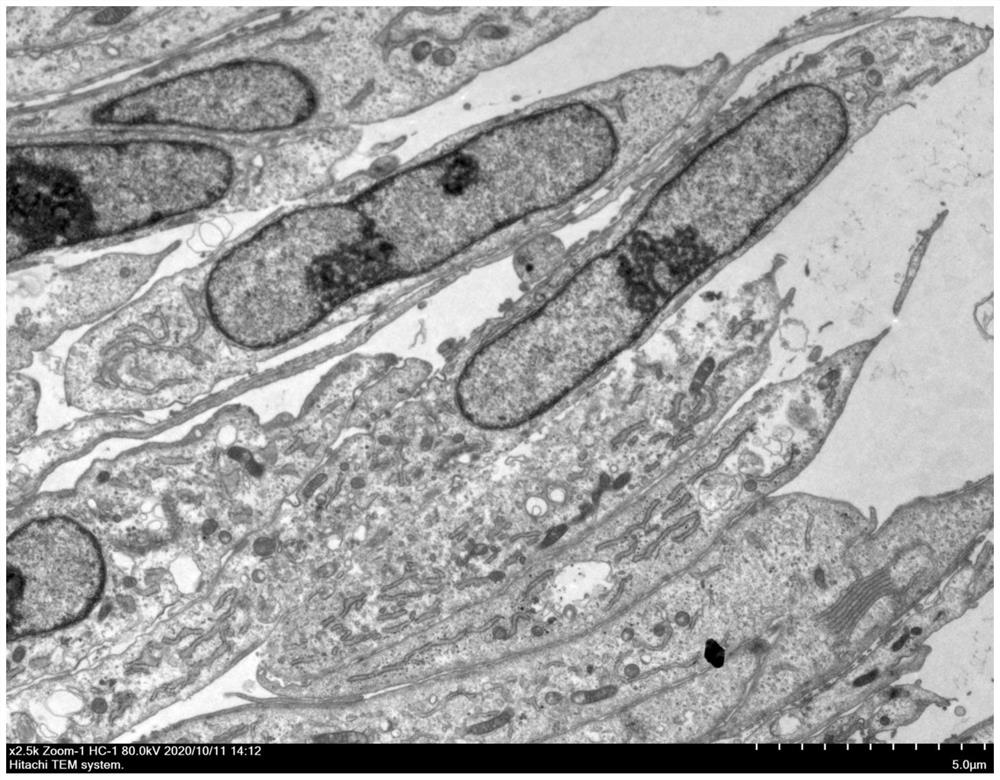 Construction method of immortalized human sebaceous gland cell line and application thereof