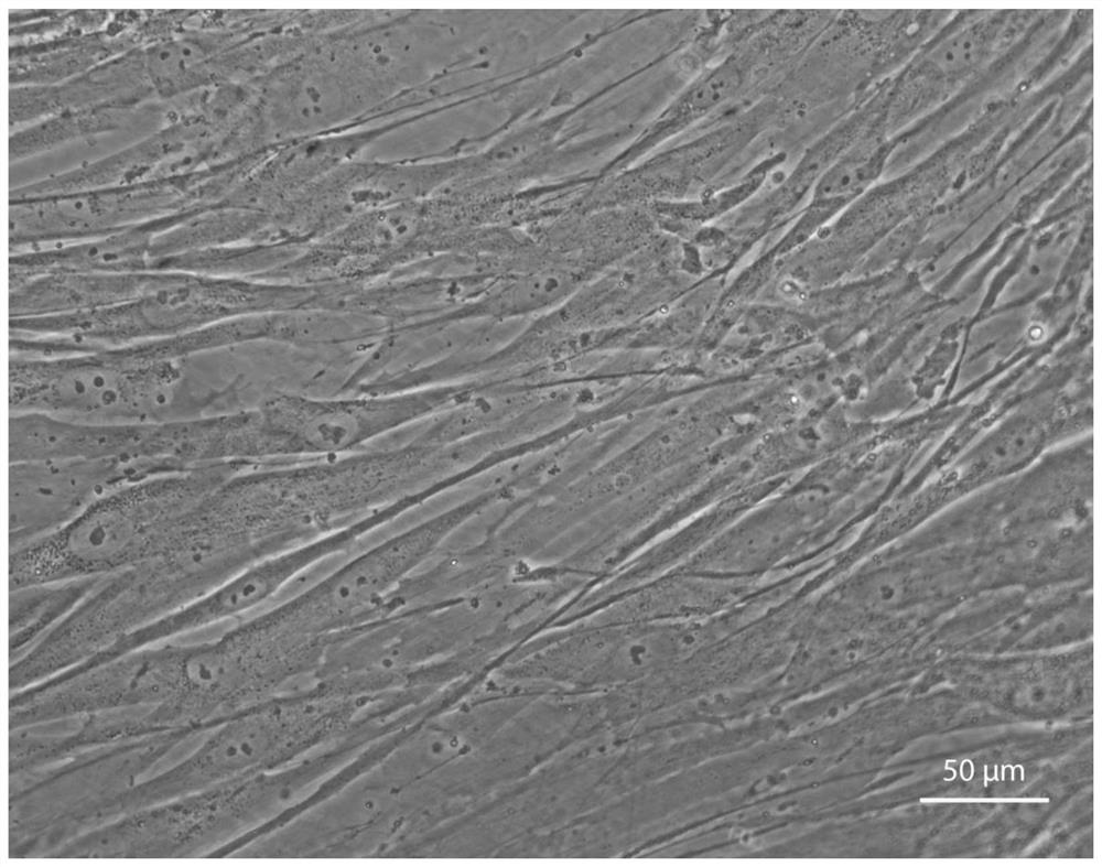 Construction method of immortalized human sebaceous gland cell line and application thereof