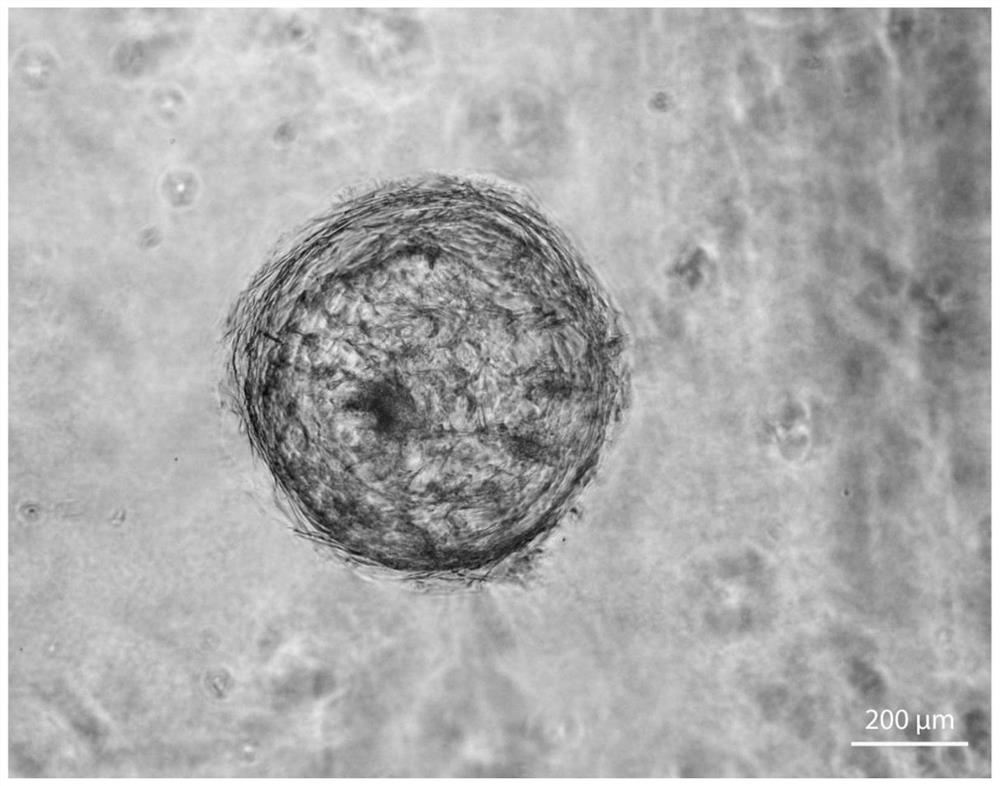 Construction method of immortalized human sebaceous gland cell line and application thereof